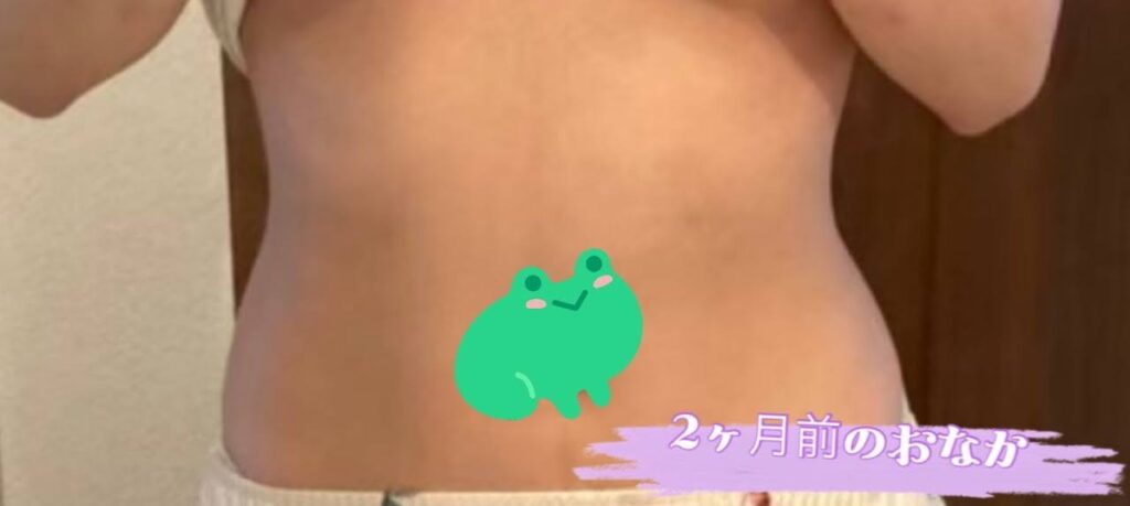 開始前（5月） のお腹